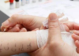 Alerjik astım teşhisinde alerji testi yapılır mı